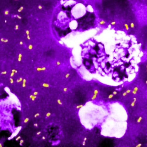 Descoperire surprinzătoare despre bacteria care a devastat lumea de mai multe ori