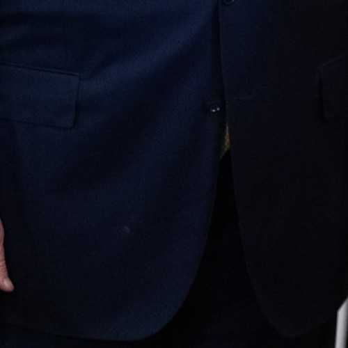 Ce este insuficiența venoasă cronică, boala de care suferă Donald Trump. Medic: „Ridică un semnal de alarmă despre problemele de fond”